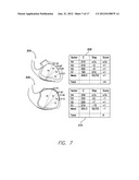 SYSTEMS AND METHODS FOR ASSESSING THE SPHERICITY AND DIMENSIONAL EXTENT OF     HEART CHAMBERS FOR USE WITH AN IMPLANTABLE MEDICAL DEVICE diagram and image