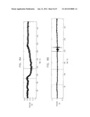 PACEMAKER WITH NO PRODUCTION diagram and image