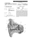 Cochlear Implant with Cochleostomy Ground diagram and image