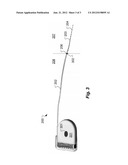 Cochlear Implant with Cochleostomy Ground diagram and image