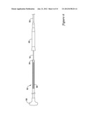 STENT DELIVERY SYSTEM diagram and image