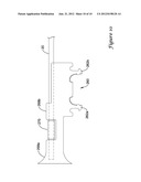 STENT DELIVERY SYSTEM diagram and image