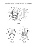 SYSTEMS AND METHODS FOR POSITIONING A HEART VALVE USING VISUAL MARKERS diagram and image
