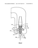 SYSTEMS AND METHODS FOR POSITIONING A HEART VALVE USING VISUAL MARKERS diagram and image