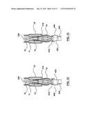 SYSTEMS AND METHODS FOR POSITIONING A HEART VALVE USING VISUAL MARKERS diagram and image