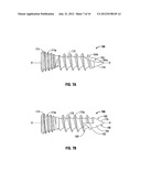 SPINAL INTERBODY SPACER diagram and image