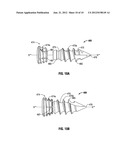 SPINAL INTERBODY SPACER diagram and image