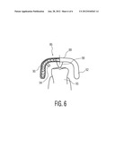 LOCATING/GUIDANCE TIP ASSEMBLY FOR A LIQUID DROPLET SPRAY TEETH CLEANING     SYSTEM diagram and image