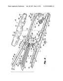 Surgical Stapler diagram and image