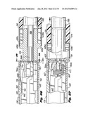 Surgical Stapler diagram and image