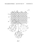 Dual-Substrate-Sensor Stack with Electrodes Opposing a Display diagram and image