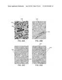 METHODS AND SYSTEMS FOR ANALYZING IMAGES OF SPECIMENS PROCESSED BY A     PROGRAMMABLE QUANTITATIVE ASSAY diagram and image