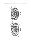 AXIAL RETENTION FEATURE FOR GAS TURBINE ENGINE VANES diagram and image