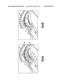 AXIAL RETENTION FEATURE FOR GAS TURBINE ENGINE VANES diagram and image