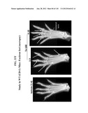 COMPOSITIONS COMPRISING NATRIURETIC PEPTIDES AND METHODS OF USE THEREOF diagram and image