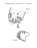 SURGICAL DRILL GUIDE AND INDEX SYSTEM diagram and image