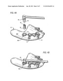 SURGICAL DRILL GUIDE AND INDEX SYSTEM diagram and image