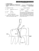 PERIODONTAL SCALER diagram and image