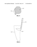 PERIODONTAL SCALER diagram and image