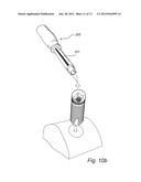 DENTAL FIXTURE, A DENTAL COMPONENT AND A DENTAL IMPLANT ASSEMBLY diagram and image