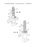 DENTAL IMPLEMENT HAVING LUMEN AND DISTAL THREADING diagram and image