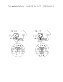 DENTAL IMPLEMENT HAVING LUMEN AND DISTAL THREADING diagram and image