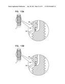 DENTAL IMPLEMENT HAVING LUMEN AND DISTAL THREADING diagram and image
