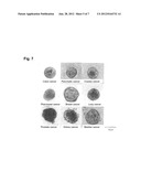 CANCER TISSUE-DERIVED CELL MASS AND A PROCESS FOR PREPARING SAME diagram and image