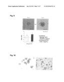 CANCER TISSUE-DERIVED CELL MASS AND A PROCESS FOR PREPARING SAME diagram and image