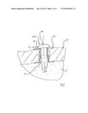 LAPAROSCOPIC ACCESS PORT AND PORT SLEEVE ARRANGEMENT diagram and image