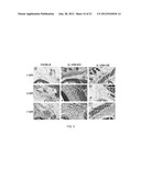 Systems and Methods for Improved In Vivo Analyte Sensor Function diagram and image