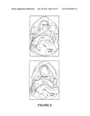 SYSTEM AND METHOD FOR IMAGE GUIDANCE DURING MEDICAL PROCEDURES diagram and image