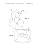 IDENTIFICATION OF OBJECTS IN ULTRASOUND diagram and image