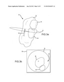 IDENTIFICATION OF OBJECTS IN ULTRASOUND diagram and image