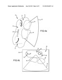 IDENTIFICATION OF OBJECTS IN ULTRASOUND diagram and image