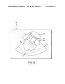 IDENTIFICATION OF OBJECTS IN ULTRASOUND diagram and image