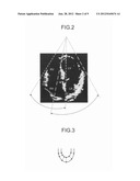 ULTRASOUND DIAGNOSIS APPARATUS, IMAGE PROCESSING APPARATUS, AND IMAGE     PROCESSING METHOD diagram and image