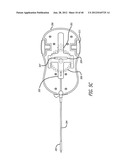 DISSECTION HANDPIECE WITH ASPIRATION MEANS FOR REDUCING THE APPEARANCE OF     CELLULITE diagram and image