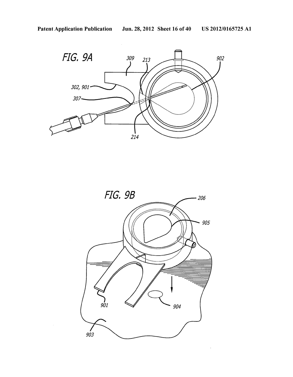 DISSECTION HANDPIECE WITH ASPIRATION MEANS FOR REDUCING THE APPEARANCE OF     CELLULITE - diagram, schematic, and image 17