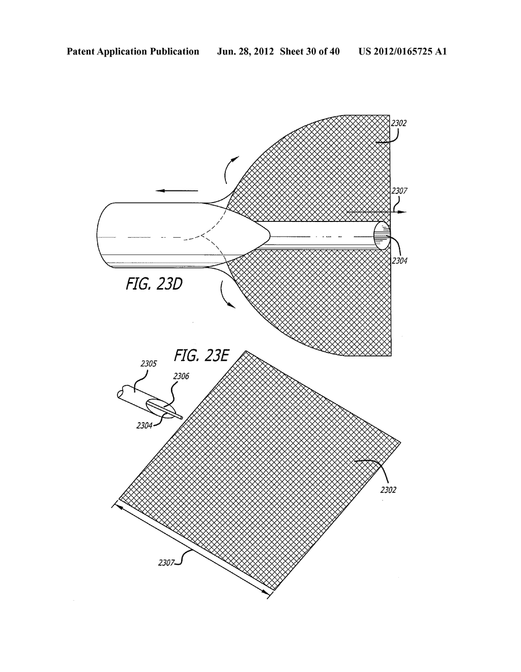 DISSECTION HANDPIECE WITH ASPIRATION MEANS FOR REDUCING THE APPEARANCE OF     CELLULITE - diagram, schematic, and image 31