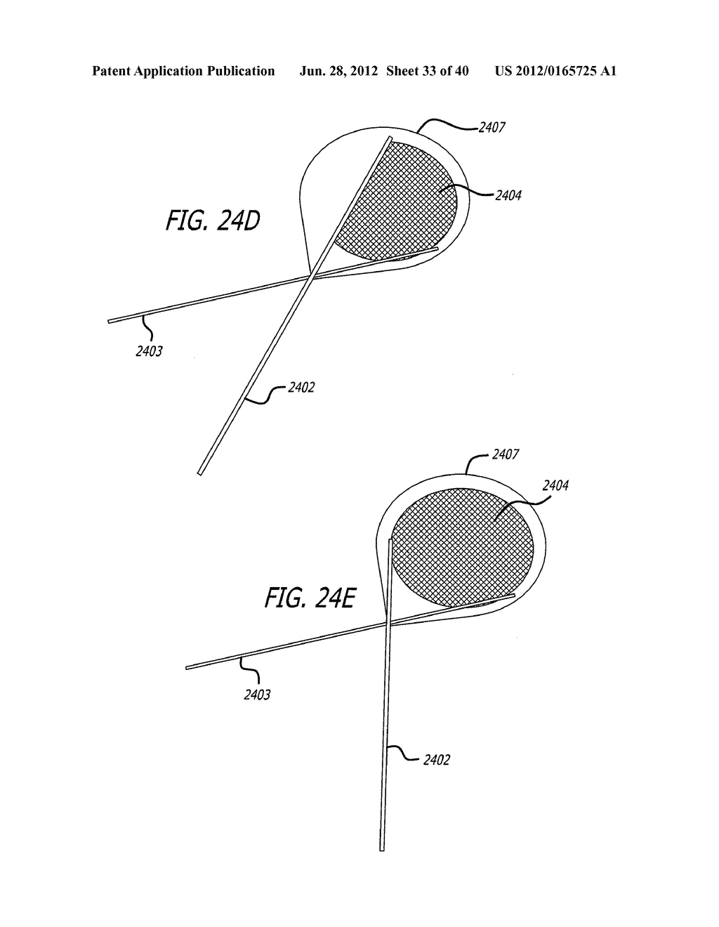 DISSECTION HANDPIECE WITH ASPIRATION MEANS FOR REDUCING THE APPEARANCE OF     CELLULITE - diagram, schematic, and image 34