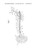 Sheaths diagram and image