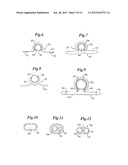 Sheaths diagram and image