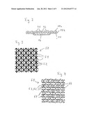 Absorbent incontinence article with improved closure system diagram and image