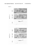  PHARMACEUTICAL COMPOSITION OF AN IONTOPHORESIS diagram and image