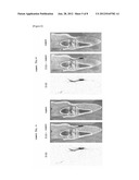  PHARMACEUTICAL COMPOSITION OF AN IONTOPHORESIS diagram and image