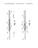 METHODS OF USING A CATHETER HAVING A BRAIDED CONDUCTIVE MEMBER diagram and image