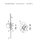 METHODS OF USING A CATHETER HAVING A BRAIDED CONDUCTIVE MEMBER diagram and image