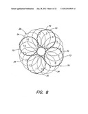 METHODS OF USING A CATHETER HAVING A BRAIDED CONDUCTIVE MEMBER diagram and image