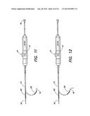 METHODS OF USING A CATHETER HAVING A BRAIDED CONDUCTIVE MEMBER diagram and image